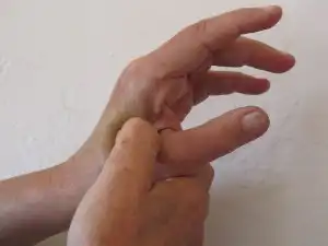 Acupressure Points for Diabetes Support 3 Hand Valley Point