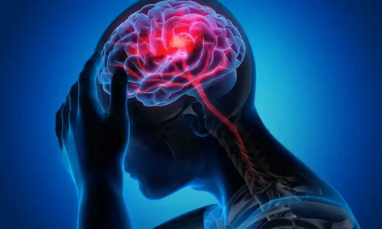 What Pressure Point Relieves Migraines? 5